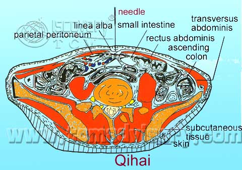 Файл:Section picture of Qihai (CV6) Acupoint.jpg