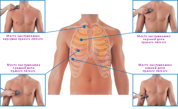 Файл:Места аускультации лёгких на передней поверхности грудной клетки.jpg