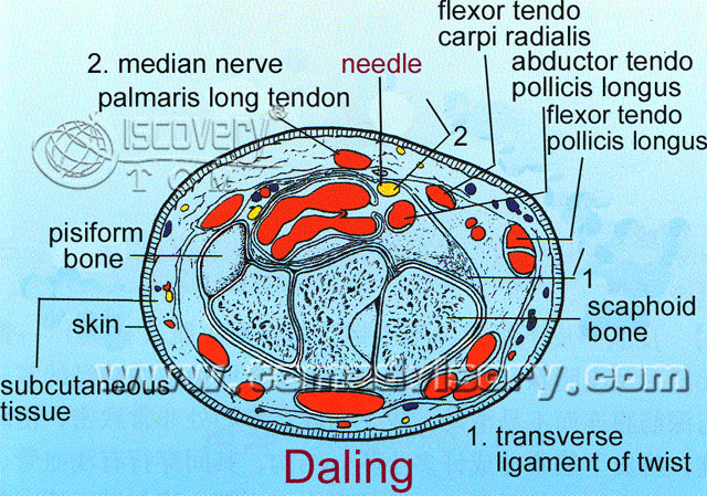 Файл:Section picture of Daling (PC7) Acupoint.jpg