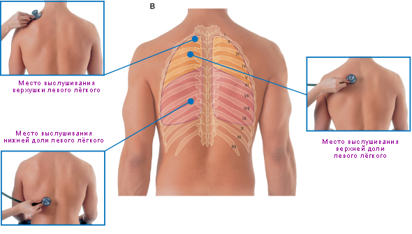 Файл:Места аускультации лёгких на задней поверхности грудной клетки.jpg