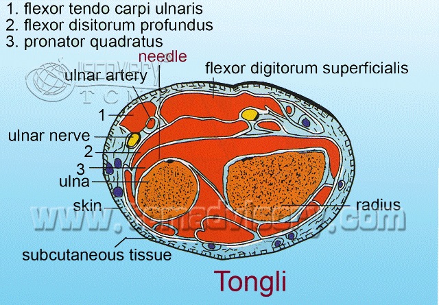 Файл:Section picture of Tongili (HT5) Acupoint.gif