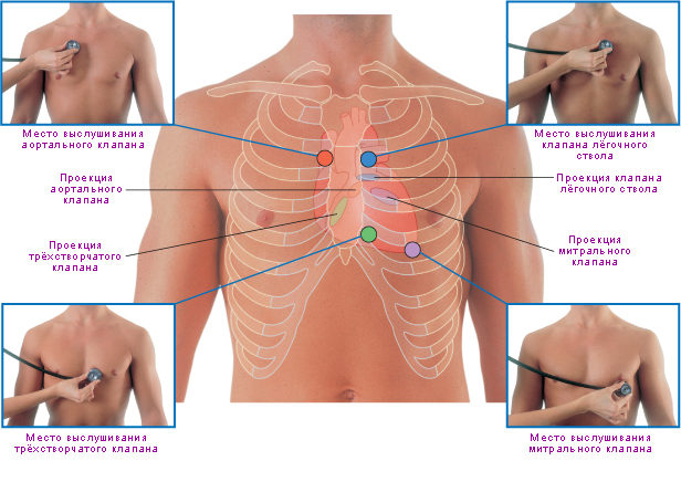 Файл:Проекции клапанов сердца на переднюю поверхность грудной клетки и места их наилучшей аускультации 2.jpg