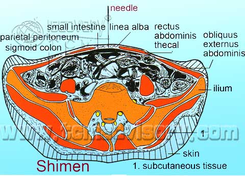 Файл:Section picture of Shimen (CV5) Acupoint.jpg