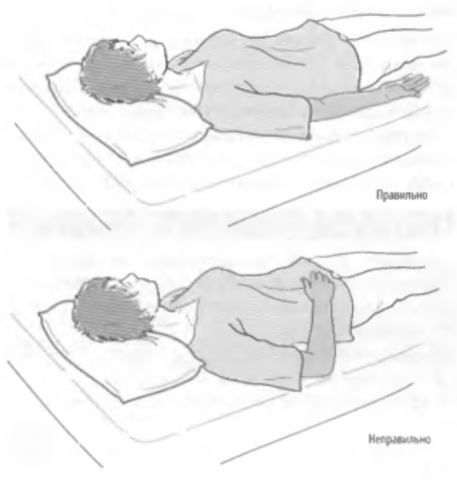 Файл:Положение руки пациента при исследовании пульса лежа.png