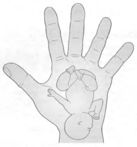 Файл:Зоны диагностики руки.png
