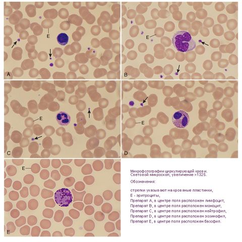 Файл:Клетки и кровяные пластинки циркулирующей крови - 2.jpg