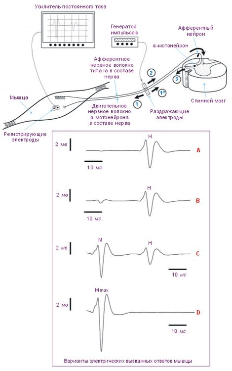 Регистрация вызванных электрических ответов мышцы. V-волна, H-рефлекс, М-ответ.