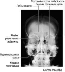 Околоносовые синусы (пазухи). Заднепередняя рентгенограмма черепа