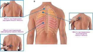 Места аускультации лёгких на задней поверхности грудной клетки