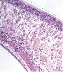 Микрофотография обонятельной области слизистой оболочки носа, покрывающей верхние раковины (низкое разрешение)