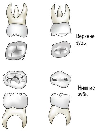 Верхние и нижние большие коренные зубы